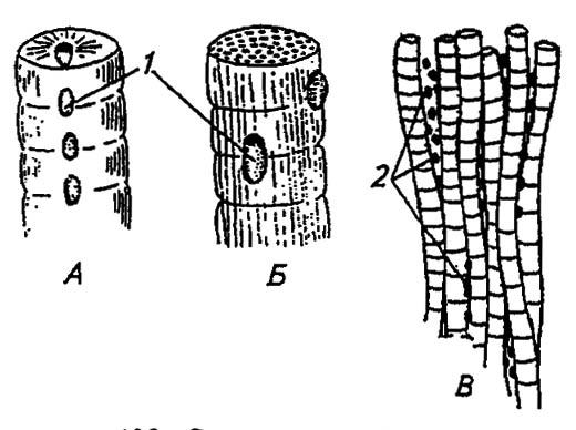 Рисунок 108. Строение трубчатых (А), плотноупакованных (Б) и фибриллярных (В) мышц насекомых (по Gillot, 1980)