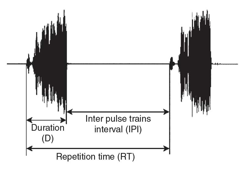 Figure 12 Temporal parameters of a vibratory signal