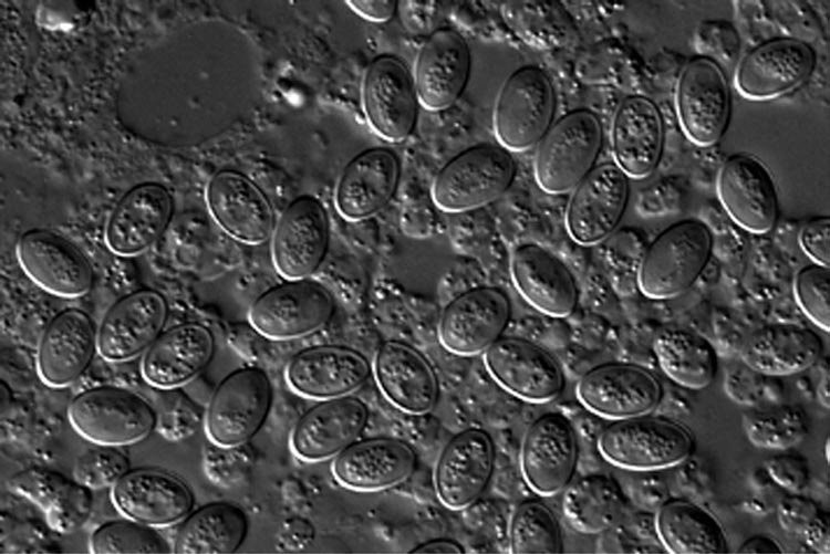 Figure 45 Light micrograph of the cysts of Malamoeba locusta released from infected Malpighian tubules.