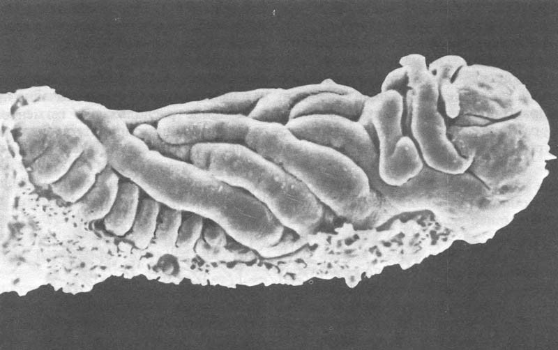 Зародыш цикадки Microstelus focifrons; х75