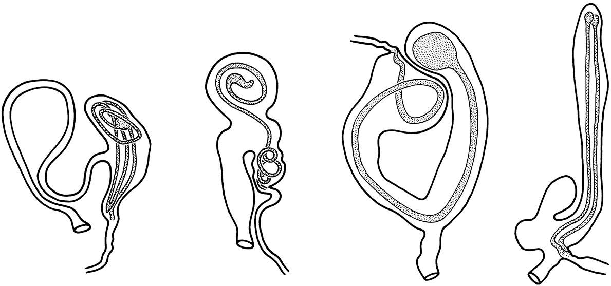 Spermatophores lying within the bursae of the female reproductive tracts of moth species from four different genera (Lepidoptera: Noctuidae).